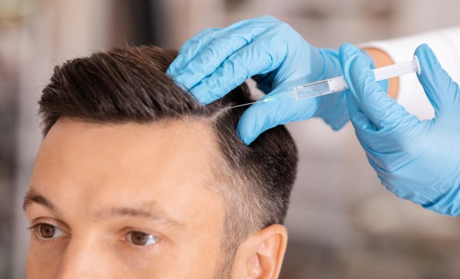 hair restoration vs hair transplants